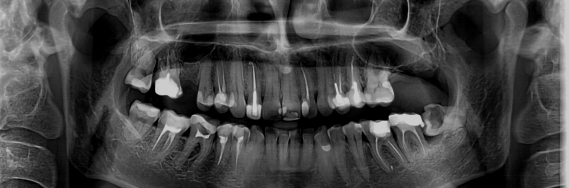 Рентген зубов Томск Ясный никитина 20 томск стоматология телефон