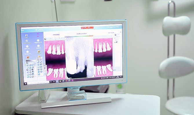 рентген зубов калининград